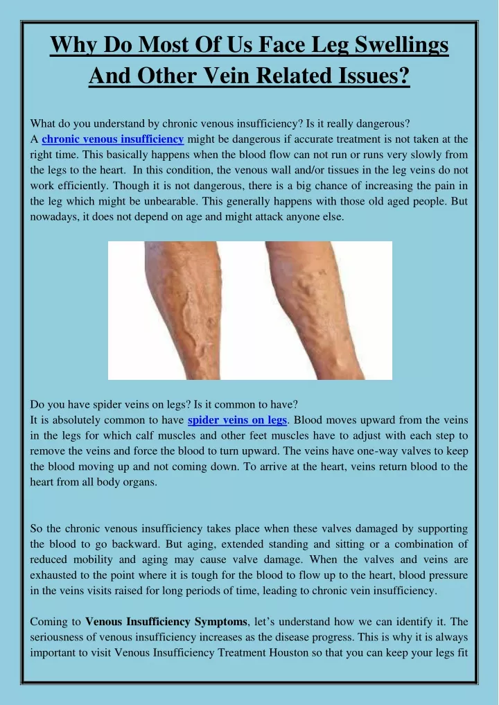 why do most of us face leg swellings and other