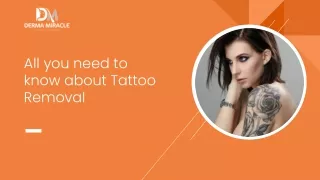 "All you need to know about Tattoo Removal "