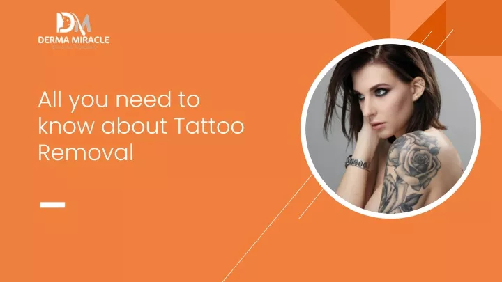 all you need to know about tattoo removal