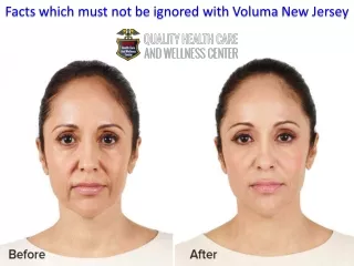 Facts which must not be ignored with Voluma New Jersey