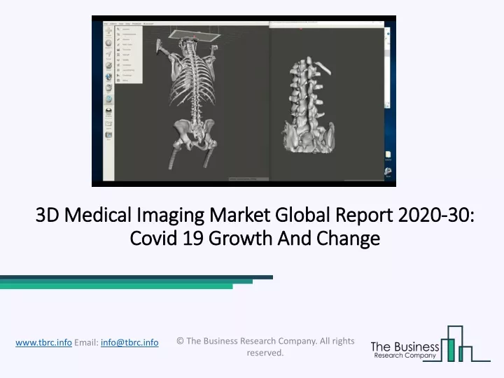 3d medical imaging market global report 2020 30 covid 19 growth and change