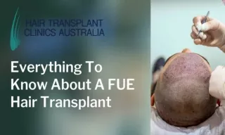 Everything To Know About A FUE Hair Transplant