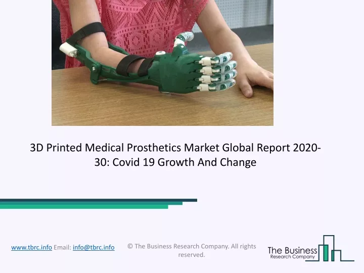 3d printed medical prosthetics market global