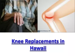 Knee Replacements in Hawaii