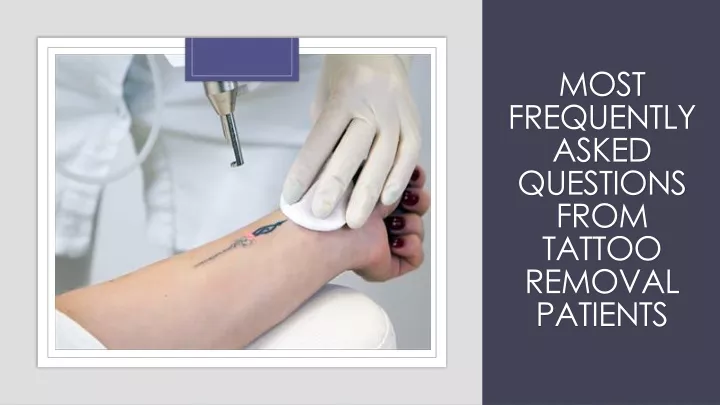 most frequently asked questions from tattoo removal patients