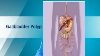 Gallbladder Polyp : Are These Indications For Gallbladder Removal