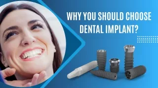 Why You Should Choose Dental Implant?