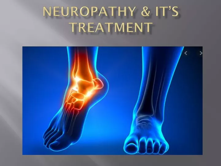 neuropathy it s treatment