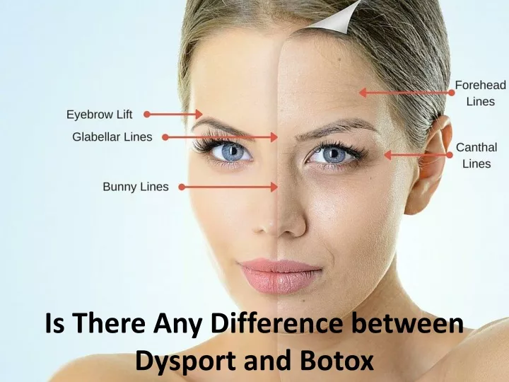 is there any difference between dysport and botox