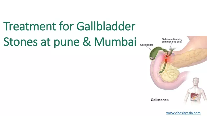 treatment for gallbladder treatment