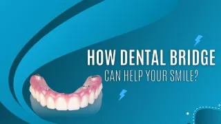 How Dental Bridge Can Help Your Smile