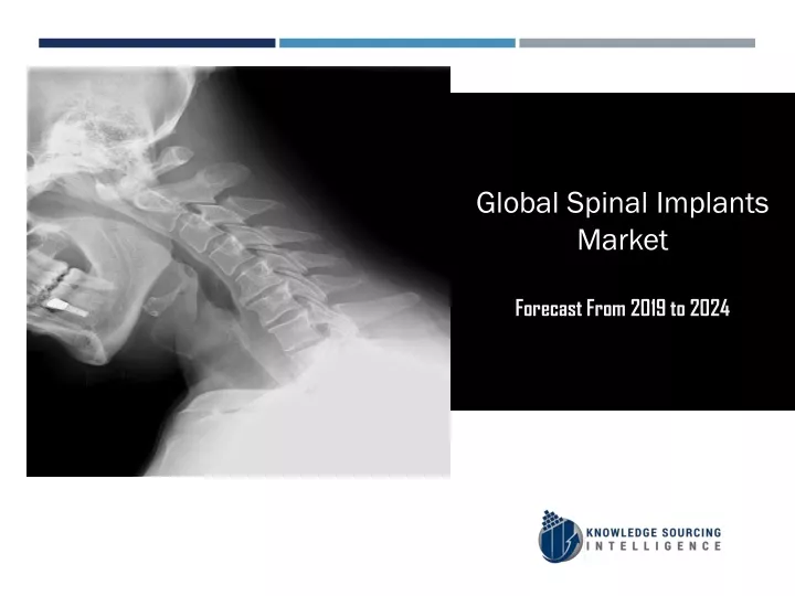 global spinal implants market forecast from 2019