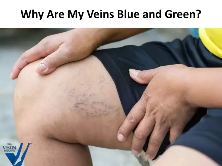 why are my veins blue and green