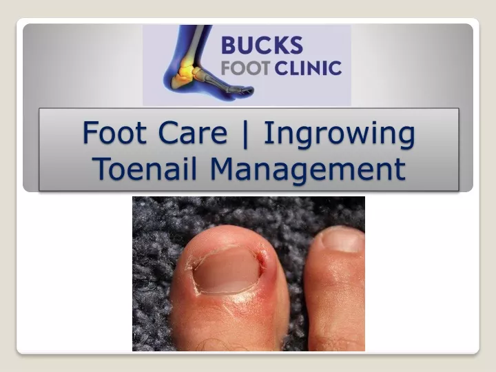 foot care ingrowing toenail management