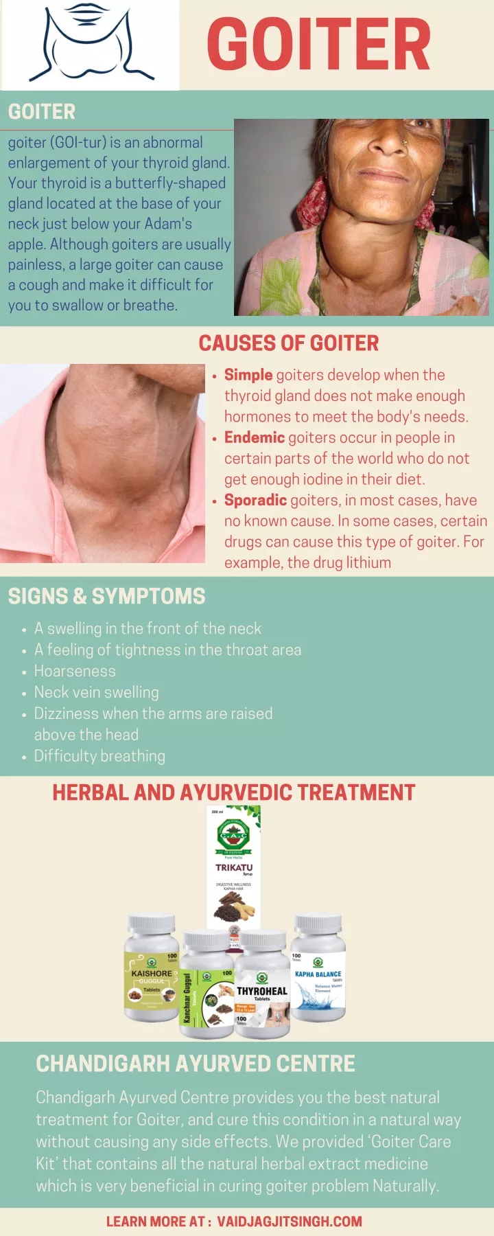 Ppt Goiter Causes Symptoms And Herbal Treatment Powerpoint