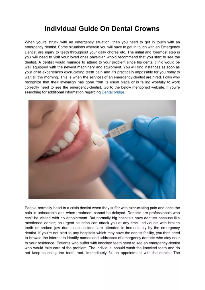 individual guide on dental crowns