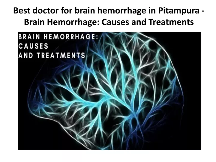 best doctor for brain hemorrhage in pitampura