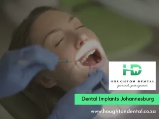 Dental Implants Johannesburg - Houghton Dental