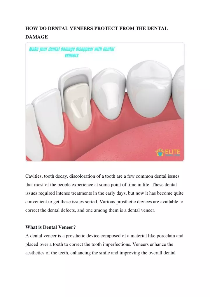 how do dental veneers protect from the dental