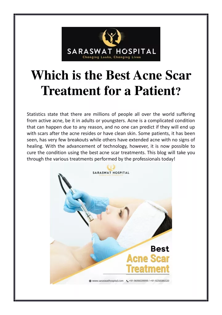 which is the best acne scar treatment