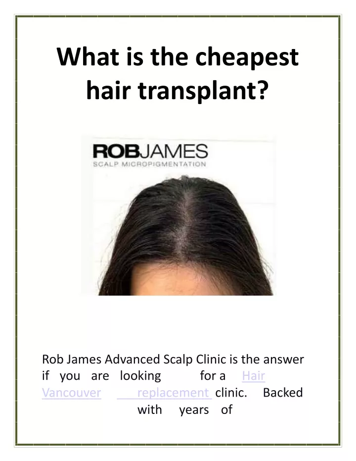 what is the cheapest hair transplant