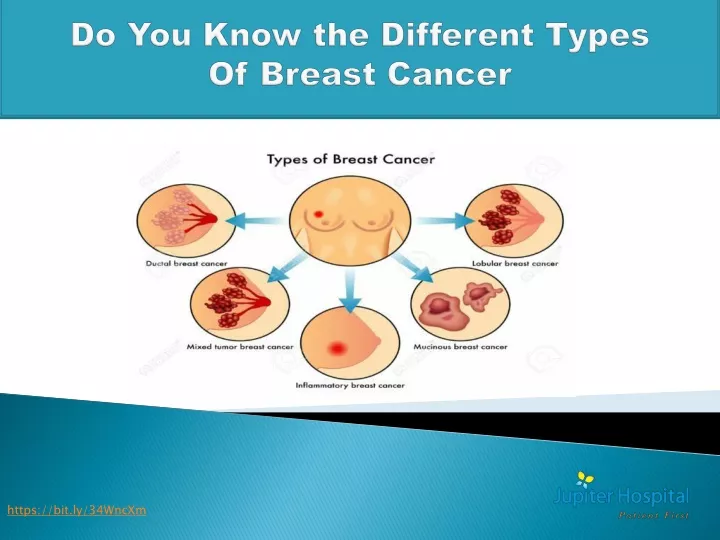 do you know the different types of breast cancer