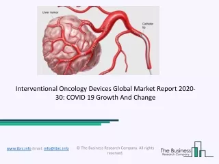 interventional oncology devices global market