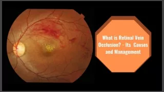 What is Retinal Vein Occlusion? – Its Causes and Management