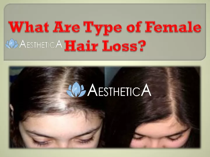 what are type of female hair loss