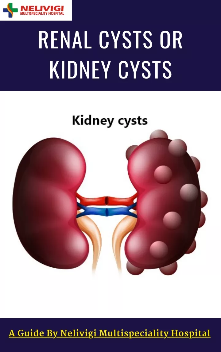 renal cysts or kidney cysts