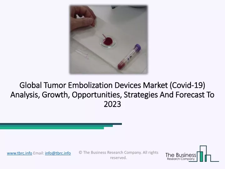 global tumor embolization devices market global