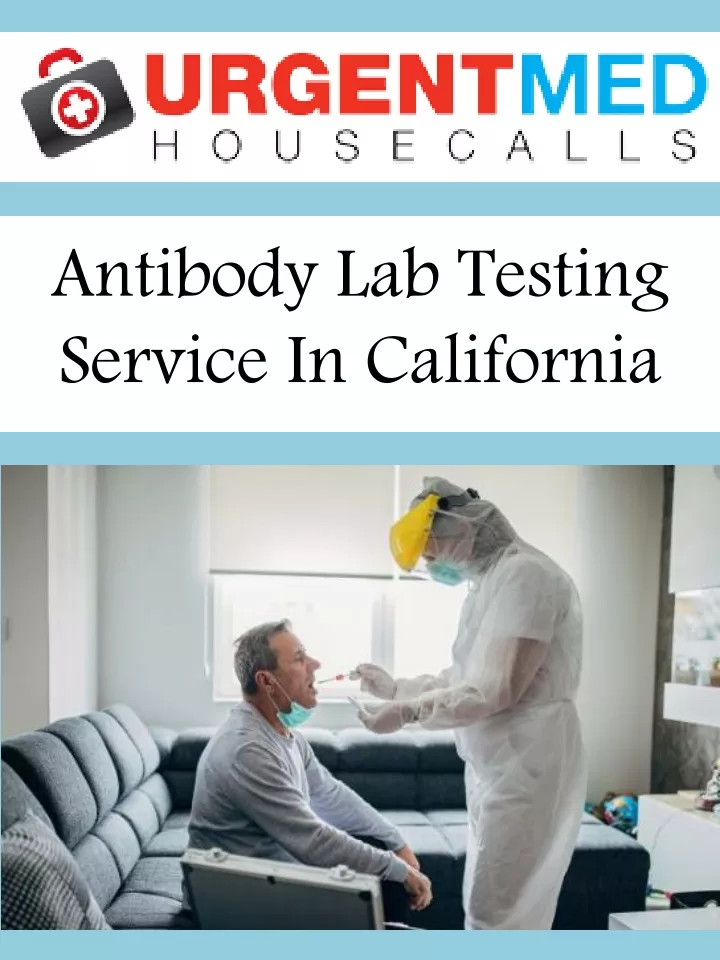 antibody lab testing service in california