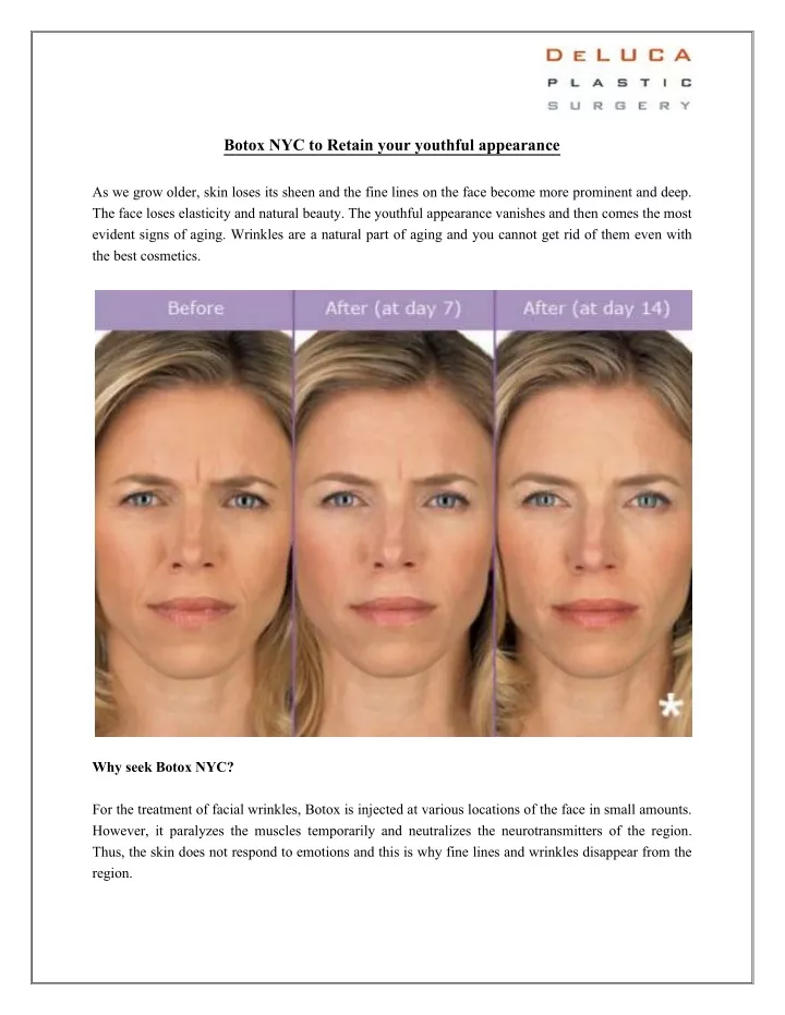 botox nyc to retain your youthful appearance