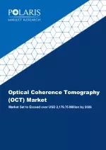 Optical Coherence Tomography (OCT) Market [By Technology (Time Domain Optical Coherence Tomography (TDOCT), Frequency Do - slide 1
