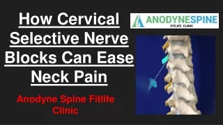 How Cervical Selective Nerve Blocks Can Ease Neck Pain- Anodyne Spine Fitlife Clinic
