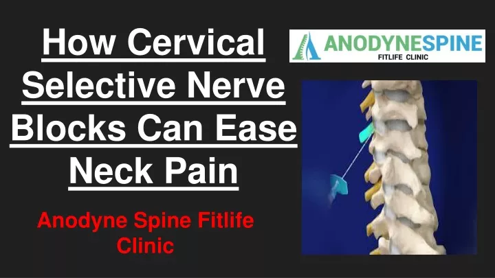 how cervical selective nerve blocks can ease neck pain