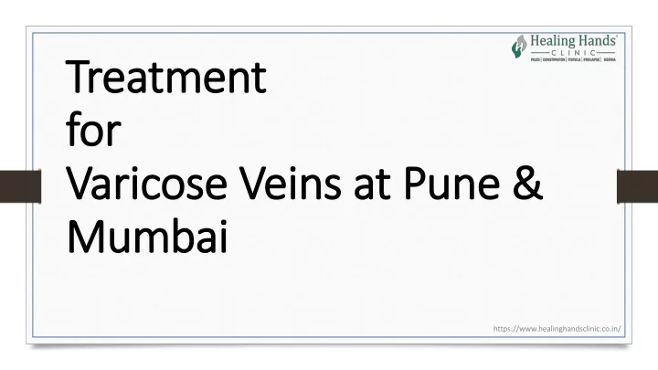 treatment treatment for for varicose veins