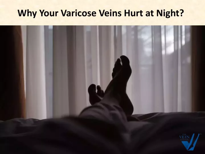 why your varicose veins hurt at night