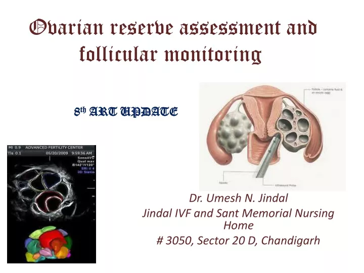 ovarian reserve assessment and follicular monitoring
