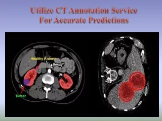 Utilize CT Annotation Service For Accurate Predictions