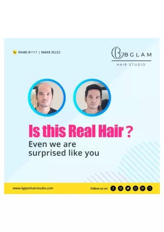 Hair replacement services Hyderabad