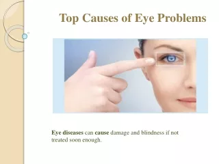 Vikash Kumar GOC - Top Causes of Eye Problems