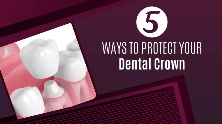 ways to protect your dental crown