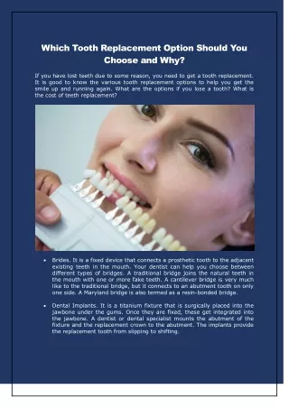 which tooth replacement option should you choose