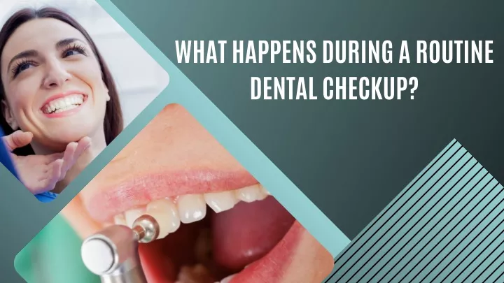 what happens during a routine dental checkup