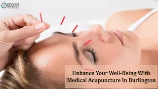 Enhance Your Well-Being With Medical Acupuncture In Burlington