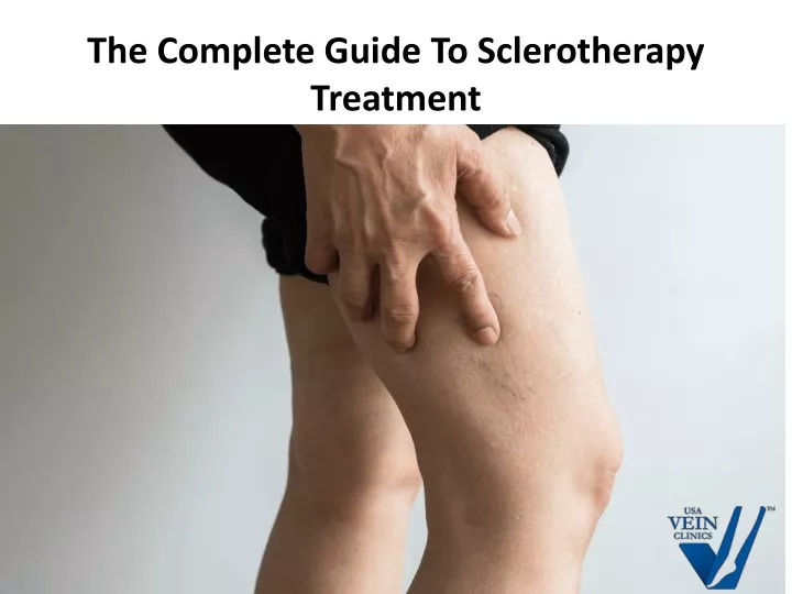 the complete guide to sclerotherapy treatment