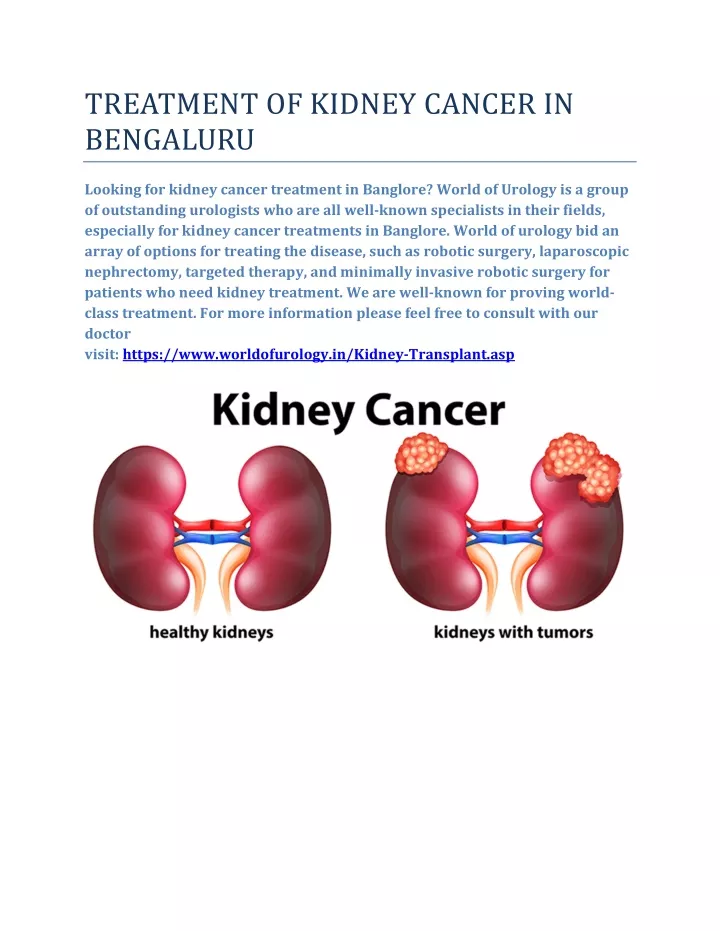treatment of kidney cancer in bengaluru