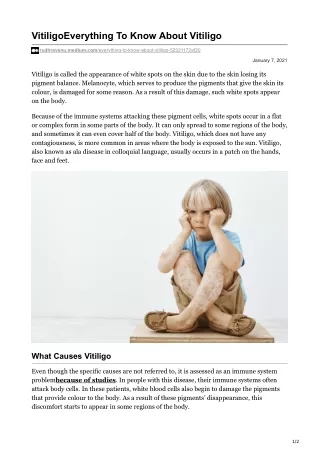 vitiligoeverything to know about vitiligo