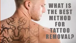what is the best method for tattoo removal